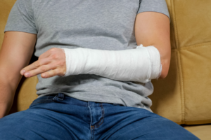 Man sitting on couch with arm on cast.